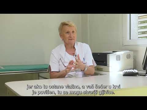 Zašto je bitna njega stopala?